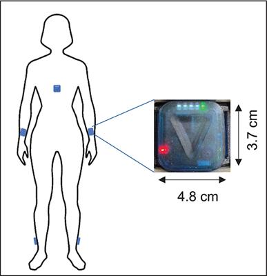 Gait pattern analysis in the home environment as a key factor for the reliable assessment of shunt responsiveness in patients with idiopathic normal pressure hydrocephalus